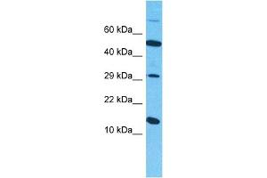 Host:  Rabbit  Target Name:  SYUB  Sample Type:  786-0 Whole Cell lysates  Antibody Dilution:  1ug/ml (beta Synuclein 抗体  (C-Term))