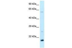 Image no. 1 for anti-TATA-Binding Protein-Associated Phosphoprotein (DR1) (AA 63-112) antibody (ABIN6747863) (DR1 抗体  (AA 63-112))