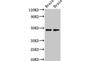 Western Blot Positive WB detected in: Rat brain tissue, Mouse brain tissue All lanes: CRHR2 antibody at 3 μg/mL Secondary Goat polyclonal to rabbit IgG at 1/50000 dilution Predicted band size: 48, 51, 47, 45, 43 kDa Observed band size: 34 kDa (CRHR2 抗体  (AA 20-108))