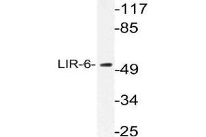 Western blot (WB) analysis of LIR-6 antibody in extracts from MCF-7 cells.