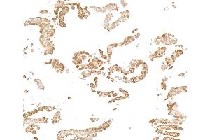 Immunocytochemistry (ICC) image for anti-Nuclear Factor-kB p65 (NFkBP65) (C-Term) antibody (ABIN7795799) (Recombinant NF-kB p65 抗体  (C-Term))