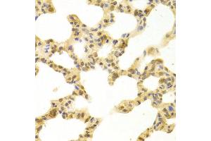 Immunohistochemistry of paraffin-embedded rat lung using POLB antibody at dilution of 1:100 (x400 lens).