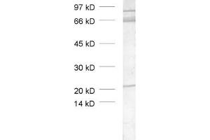 dilution: 1 : 1000, sample: crude synaptic vesicle fraction of rat brain (LP2) (TRIM9 抗体  (AA 1-250))