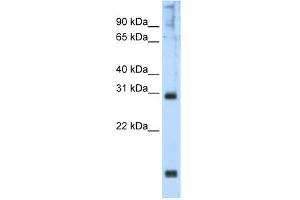 WB Suggested Anti-Hoxb1 Antibody Titration:  2. (HOXB1 抗体  (N-Term))
