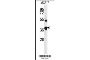 Western blot analysis of FBP1 Antibody in MCF-7 cell line lysates (35ug/lane) (FBP1 抗体  (AA 125-156))