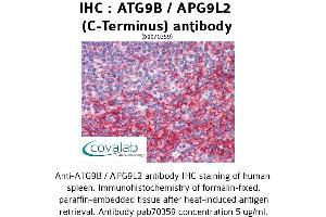 Image no. 2 for anti-Autophagy Related 9B (ATG9B) (C-Term) antibody (ABIN1732024) (ATG9B 抗体  (C-Term))