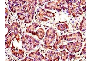 Immunohistochemistry of paraffin-embedded human pancreatic tissue using ABIN7175846 at dilution of 1:100 (WISP1 抗体  (AA 130-251))