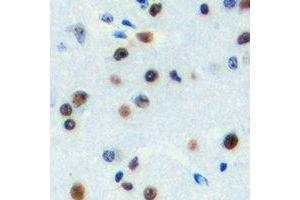 Immunohistochemical analysis of ZNF785 staining in human brain formalin fixed paraffin embedded tissue section. (ZNF785 抗体)