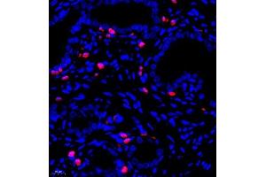 Immunofluorescence (Paraffin-embedded Sections) (IF (p)) image for anti-S100 Calcium Binding Protein A9 (S100A9) antibody (ABIN7075497)