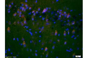 Immunofluorescence (IF) image for anti-Glutamate Receptor, Ionotropic, N-Methyl D-Aspartate 2a (GRIN2A) (AA 851-950) antibody (ABIN747353)