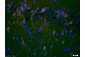 Formalin-fixed and paraffin-embedded rat brain labeled with Anti-NR2A/NMDAR2A Polyclonal Antibody, Unconjugated (ABIN747353) 1:200, overnight at 4°C, The secondary antibody was Goat Anti-Rabbit IgG, Cy3 conjugated used at 1:200 dilution for 40 minutes at 37°C. (NMDAR2A 抗体  (AA 851-950))