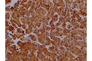 Immunohistochemistry (IHC) image for anti-Citrate Lyase beta Like (CLYBL) (AA 23-340) antibody (ABIN7147805)