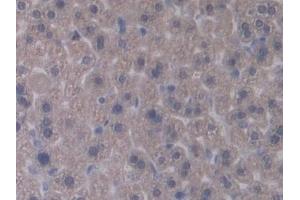 Immunohistochemistry (IHC) image for anti-Interleukin 12 alpha (IL12A) (AA 23-215) antibody (ABIN7430654)