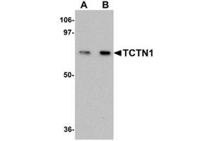TCTN1 抗体  (N-Term)