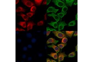 ABIN6264567 and ABIN6276965 staining Hela cells by IF/ICC. (RAB27A 抗体  (C-Term))