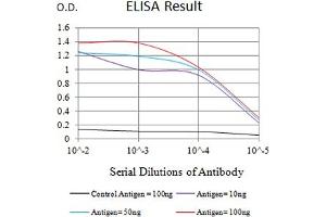 Black line: Control Antigen (100 ng),Purple line: Antigen (10 ng), Blue line: Antigen (50 ng), Red line:Antigen (100 ng) (IL21 Receptor 抗体  (AA 20-232))