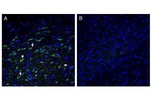 Immunohistochemistry (IHC) image for anti-Solute Carrier Family 30, Member 10 (SLC30A10) (AA 361-374), (Intracellular) antibody (ABIN7043717)