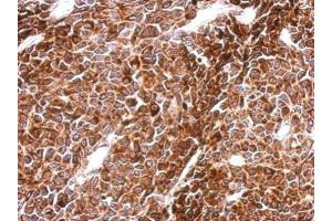 IHC-P Image Immunohistochemical analysis of paraffin-embedded BT483 xenograft, using PHF16, antibody at 1:500 dilution. (PHF16 抗体  (C-Term))