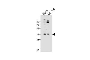 All lanes : Anti-RQCD1 Antibody (Center) at 1:500 dilution Lane 1: HL-60 whole cell lysate Lane 2: MOLT-4 whole cell lysate Lysates/proteins at 20 μg per lane. (RQCD1 抗体  (AA 106-134))