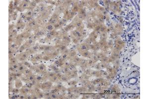 Immunoperoxidase of monoclonal antibody to CBS on formalin-fixed paraffin-embedded human liver. (CBS 抗体  (AA 1-100))