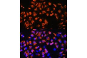 Immunofluorescence analysis of HeLa cells using AGRN Rabbit pAb (ABIN7265516) at dilution of 1:100. (AGRN 抗体  (AA 30-350))