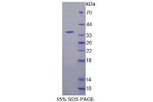 SDS-PAGE analysis of Mouse CDK20 Protein. (CCRK 蛋白)