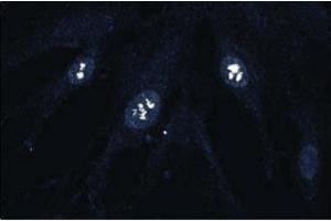 Immunofluorescence staining of human fibroblasts. (CDK4 抗体  (AA 1-303))
