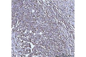 IHC analysis of GLUD1/2 using anti-GLUD1/2 antibody (ABIN7602000). (GLUD1 / GLUD2 (AA 54-553) 抗体)