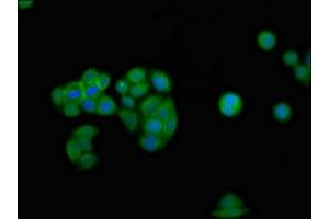 Immunofluorescence staining of PC-3 cells with ABIN7156602 at 1:100, counter-stained with DAPI. (IFNGR2 抗体  (AA 28-205))