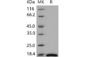 CRABP2 Protein (His tag)