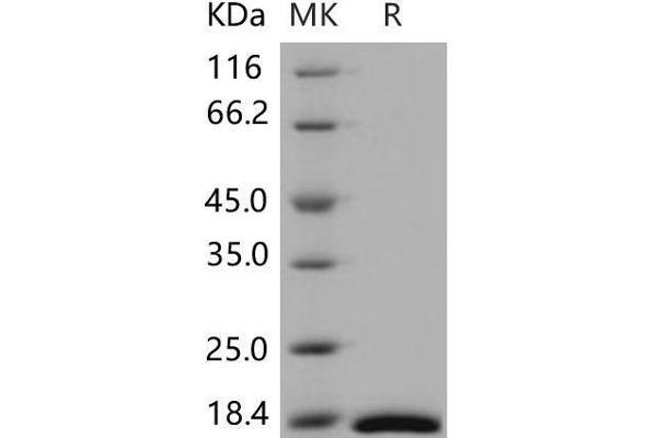 CRABP2 Protein (His tag)