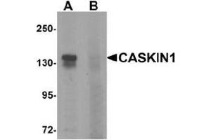Western blot analysis of CASKIN1 in HeLa cell lysate with CASKIN1 Antibody  at 1 μg/ml in (A) the absence and (B) the presence of blocking peptide. (CASKIN1 抗体  (Middle Region))