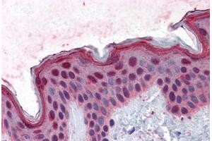 Human Skin: Formalin-Fixed, Paraffin-Embedded (FFPE) (FAM50A 抗体  (AA 1-89))
