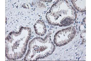 Image no. 5 for anti-NIF3 NGG1 Interacting Factor 3-Like 1 (NIF3L1) antibody (ABIN1496618)