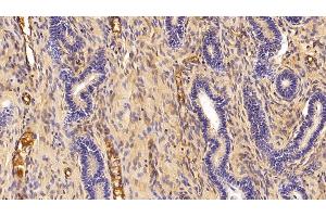 Detection of Hpt in Porcine Uterus Tissue using Polyclonal Antibody to Haptoglobin (Hpt) (Haptoglobin 抗体  (AA 123-307))