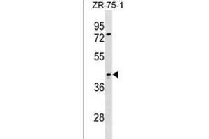 SIRPB2 Antibody (C-term) (ABIN1536893 and ABIN2838213) western blot analysis in ZR-75-1 cell line lysates (35 μg/lane). (SIRPb2 抗体  (C-Term))