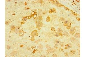Immunohistochemistry of paraffin-embedded human placenta tissue using ABIN7165176 at dilution of 1:100 (CNPY4 抗体  (AA 22-248))