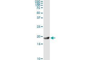 Immunoprecipitation (IP) image for anti-Ferritin, Light Polypeptide (FTL) (AA 1-175) antibody (ABIN947883)