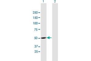 Western Blot analysis of UBQLNL expression in transfected 293T cell line by UBQLNL MaxPab polyclonal antibody. (UBQLNL 抗体  (AA 1-475))