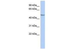 Image no. 1 for anti-GRINL1A Complex Locus (GCOM1) (AA 215-264) antibody (ABIN6743597) (GCOM1 抗体  (AA 215-264))