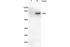 L1 rat brain, L2 human colon carcinoma lysates probed (ABIN746558) at 1:200 in 4 °C. (CRTC1 抗体  (pSer151))