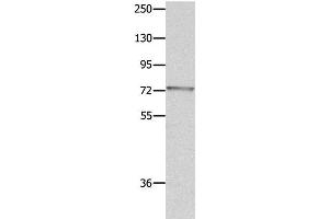 Western Blot analysis of Mouse eye tissue using MUC20 Polyclonal Antibody at dilution of 1:1400 (MUC20 抗体)