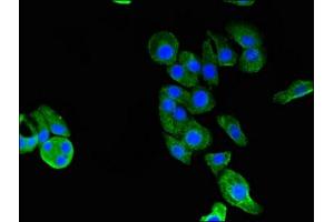 Immunofluorescence (IF) image for anti-Glycyl-tRNA Synthetase (GARS) (AA 1-389) antibody (ABIN7154194)