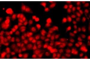 Immunofluorescence analysis of A549 cells using THAP1 Polyclonal Antibody (THAP1 抗体)