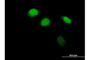 Immunofluorescence of purified MaxPab antibody to ZBTB12 on HeLa cell. (ZBTB12 抗体  (AA 1-459))