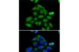 Immunofluorescence analysis of MCF7 cells using ELAC2 Polyclonal Antibody (ELAC2 抗体)