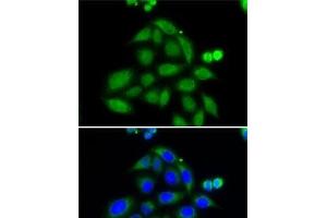 Immunofluorescence analysis of MCF7 cells using ELAC2 Polyclonal Antibody (ELAC2 抗体)