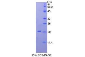SDS-PAGE analysis of Human ACP3 Protein. (ACPP 蛋白)