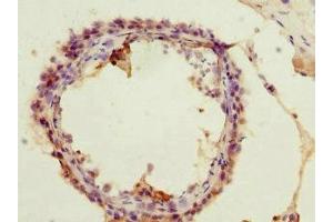 Immunohistochemistry of paraffin-embedded human testis tissue using ABIN7142950 at dilution of 1:100 (ACSS2 抗体  (AA 462-701))