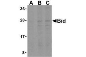 Western blot analysis of Bid in A549 cell lysates with Bid AP30148PU-N antibody at (A) 0. (BID 抗体  (Middle Region))
